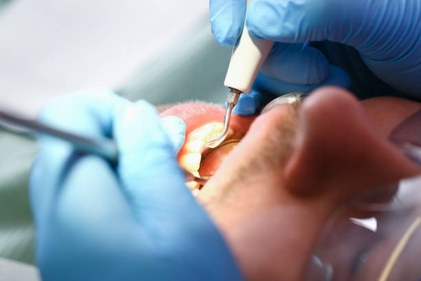 Best Emergency Dentist for Knocked-Out Tooth in Belle Plaine, IA