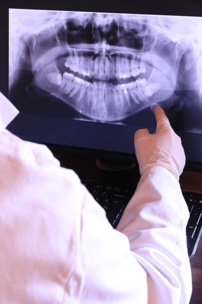 Best Emergency Dentist for Lost Fillings or Crowns in Belle Plaine, IA